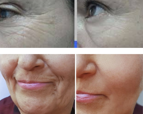 Trans Resveratrol melhora a saúde cardiovascular? 