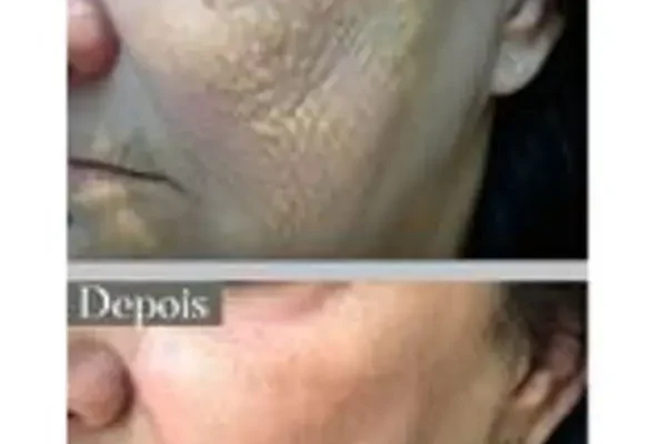 Quais os principais benefícios do Trans Resveratrol para a saúde? 